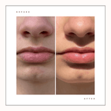 Super Balm For Face & Lips - Joik USA