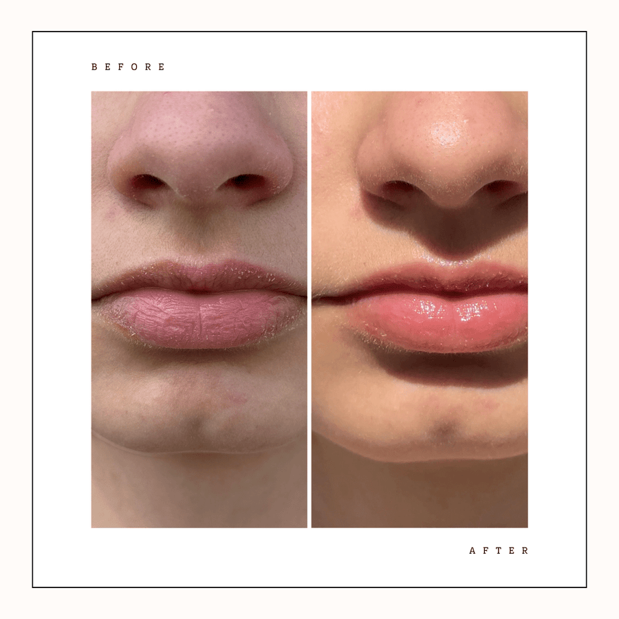 Super Balm For Face & Lips - Joik USA